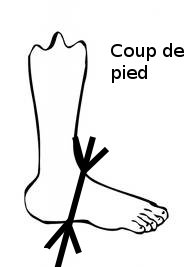 Chaussure coup best sale de pied fort